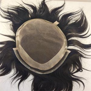 Hair Patch in Goa